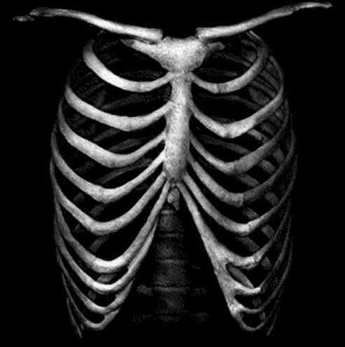 RIB CAGE (524)